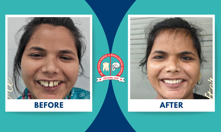 braces treatment at dr tayyeb's